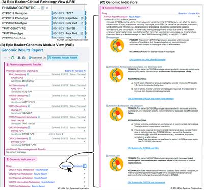 Integration of pharmacogenetic data in epic genomic module drives clinical decision support alerts